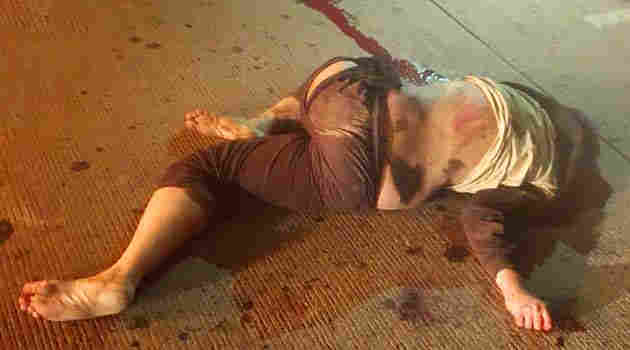 road accident
